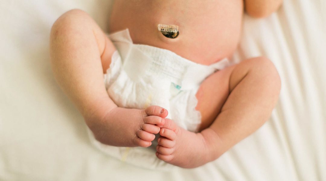 Hindari Infeksi Tali Pusar Bayi dengan 3 Cara Ini